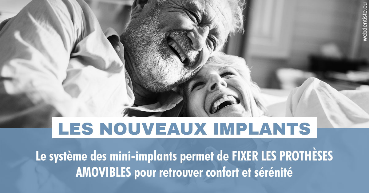 https://www.cabinetaubepines.lu/Les nouveaux implants 2