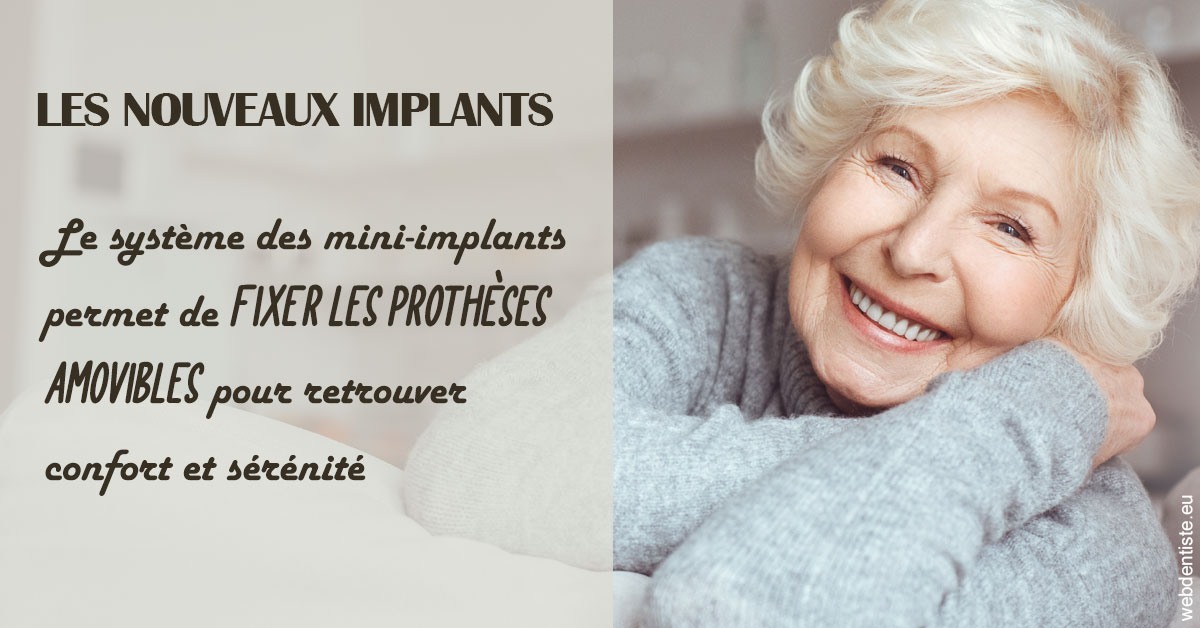 https://www.cabinetaubepines.lu/Les nouveaux implants 1