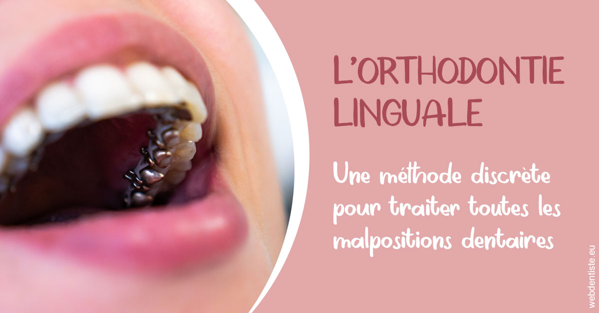 https://www.cabinetaubepines.lu/L'orthodontie linguale 2