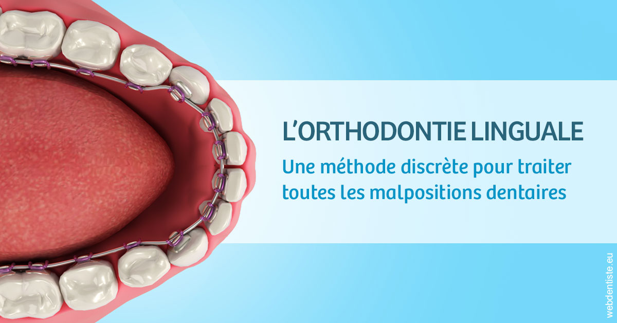 https://www.cabinetaubepines.lu/L'orthodontie linguale 1