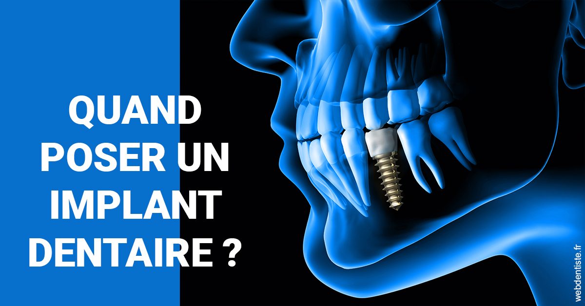 https://www.cabinetaubepines.lu/Les implants 1
