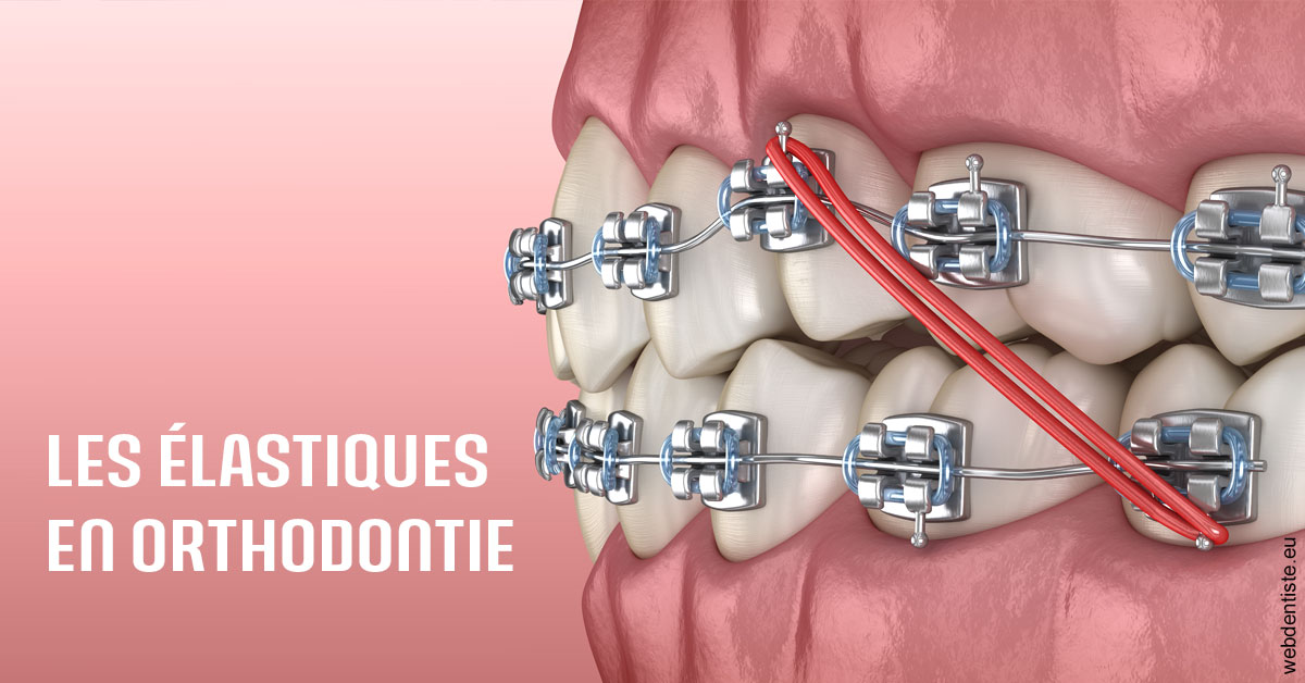 https://www.cabinetaubepines.lu/Elastiques orthodontie 2