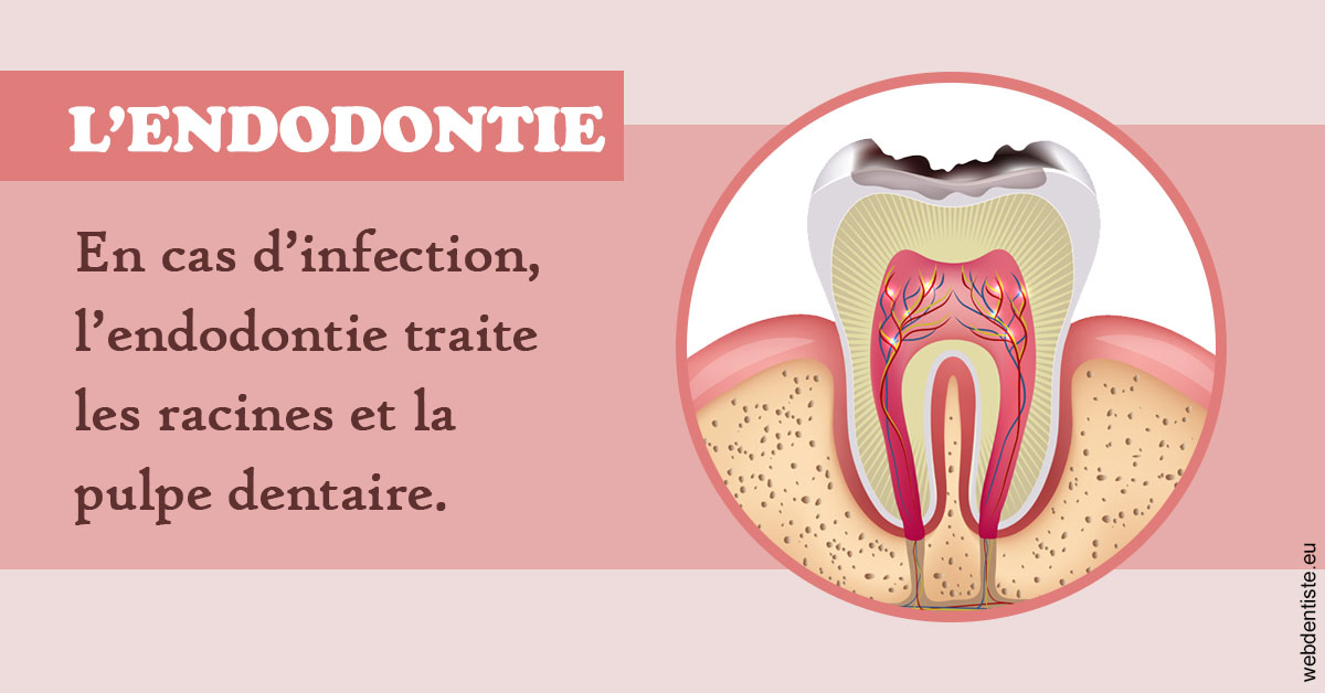 https://www.cabinetaubepines.lu/L'endodontie 2