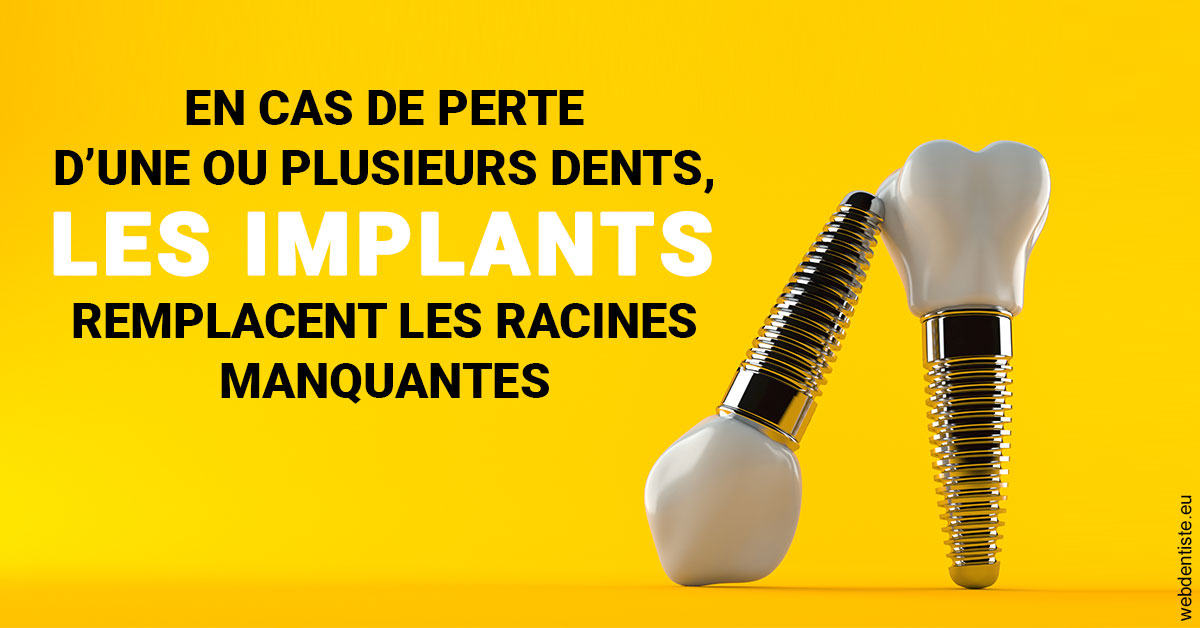 https://www.cabinetaubepines.lu/Les implants 2